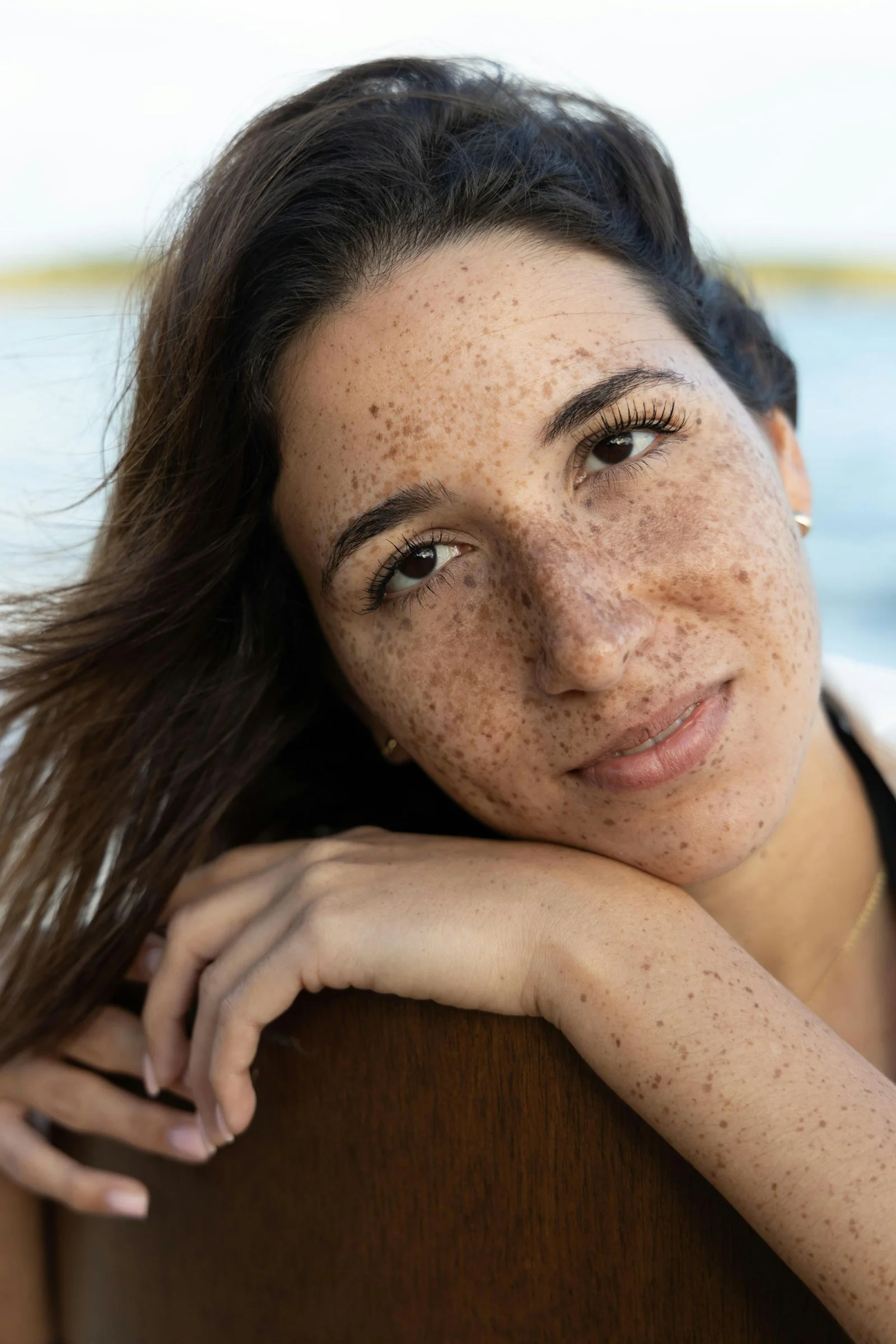 A woman with freckles looking at the camera